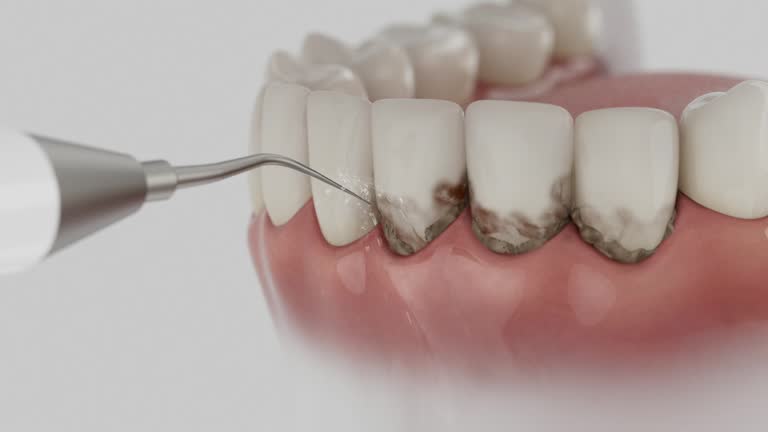 Trusted Emergency Dentist service in Sallisaw, OK - Dentist Open Now